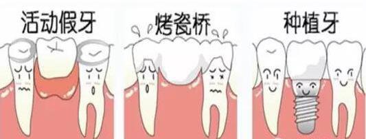 帶假牙的價(jia) 格