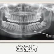 牙醫為什麽叫你拍口腔全景片 有什麽用?