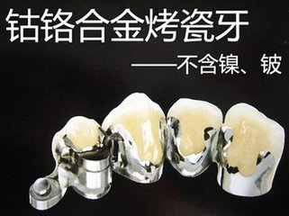 鈷鉻合金烤瓷牙的價(jia) 格