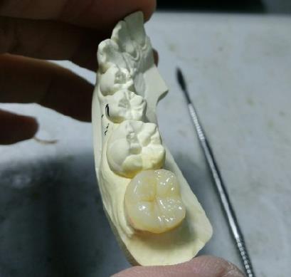 高嵌體(ti) 圖片