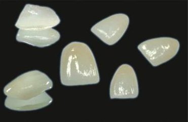 根管治療後變色做牙齒貼麵好嗎