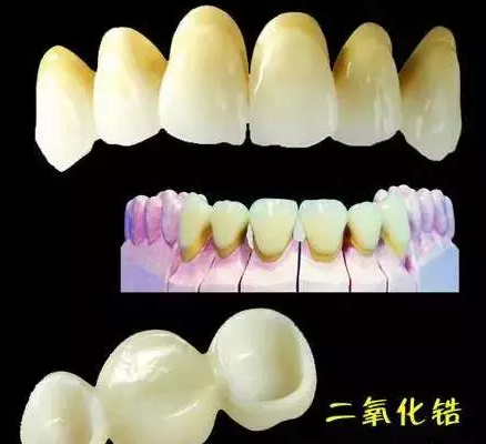 氧化鋯全瓷牙多少錢