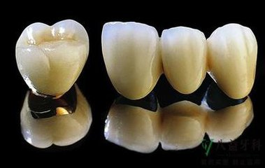 一口烤瓷牙多少錢