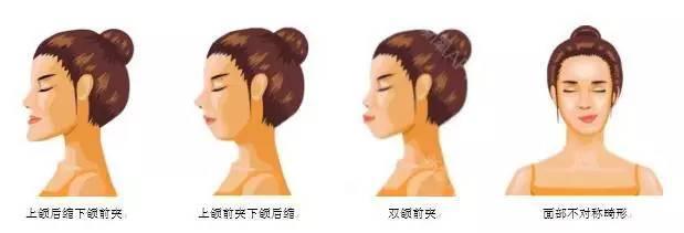 牙頜麵畸形的原因