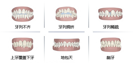 口腔正畸的病因