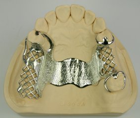 純鈦牙托多少錢