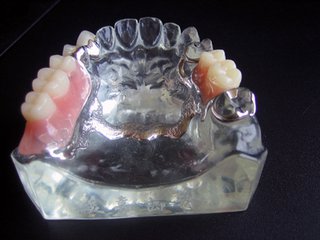 純鈦牙托價(jia) 格