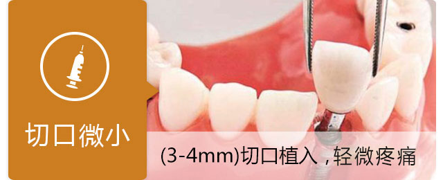 微創種植牙