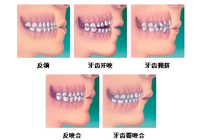 30歲牙齒矯正