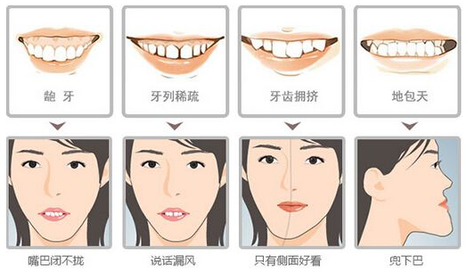 骨性齙牙和非骨性齙牙