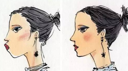 牙齒矯正要多少錢