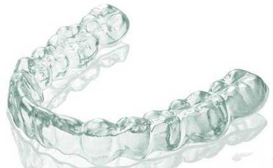 牙齒矯正器多少錢