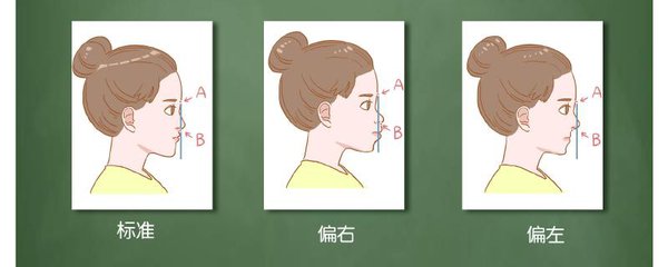 牙性齙牙與(yu) 骨性齙牙圖