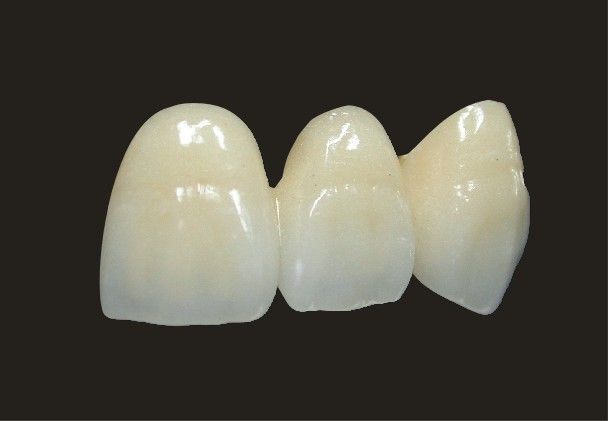 半貴金屬烤瓷牙價(jia) 格