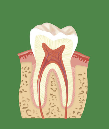 牙齒種植多少錢一顆