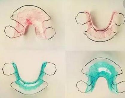 牙齒矯正複診的問題