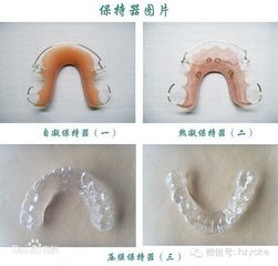 戴保持器後還要複診嗎