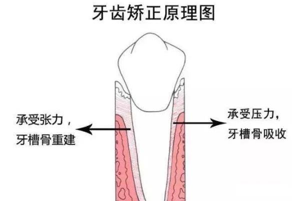 牙齒矯正的不適