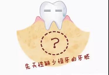 兒(er) 童乳牙滯留怎麽(me) 辦