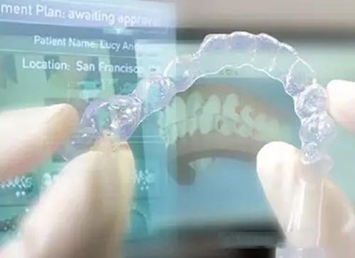 牙齒有縫隙怎麽(me) 矯正