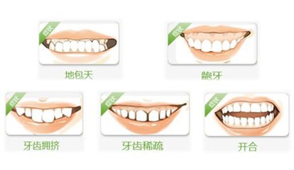 牙齒畸形矯正價(jia) 格