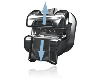 成人矯正牙齒要多久