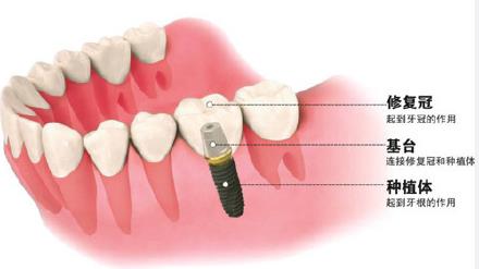 牙齒美容的價(jia) 格