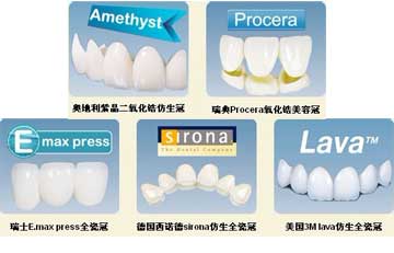 鑲牙需要多少錢