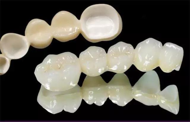 假牙的材料有幾種