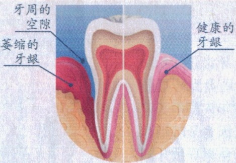固定假牙多少錢一顆