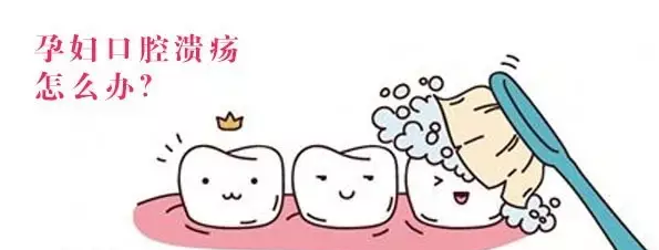 孕婦潰瘍怎麽(me) 辦