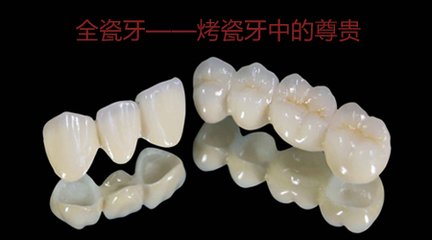 氧化鋯全瓷牙幾年後還能用嗎