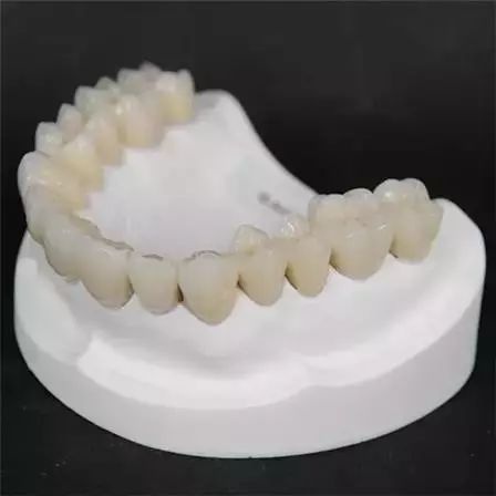 鈦合金烤瓷牙有沒有危害
