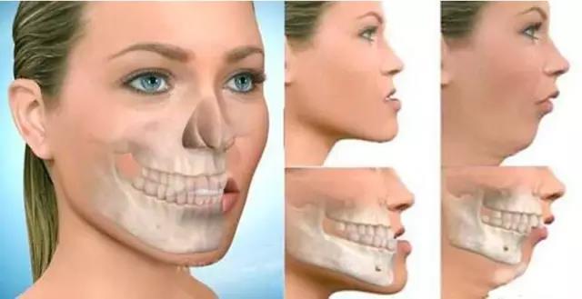 牙齒矯正適合的年齡