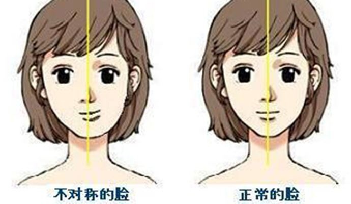 偏側(ce) 咀嚼的原因有哪些