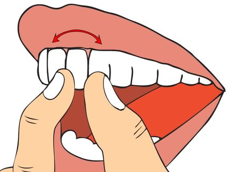 牙齒鬆動的原因