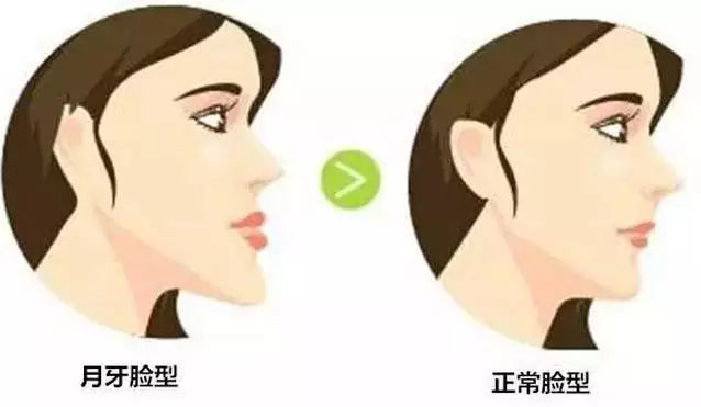 矯正牙齒多大年齡合適