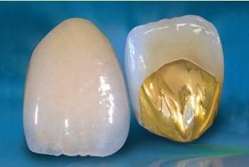 牙縫大是牙周炎導致的嗎