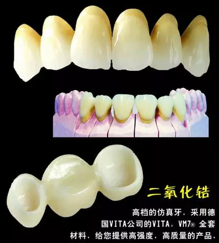 二氧化鋯全瓷牙價(jia) 格