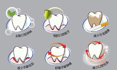 牙齒美容之洗牙多少錢