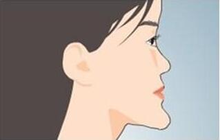 牙齒美容正畸多少錢
