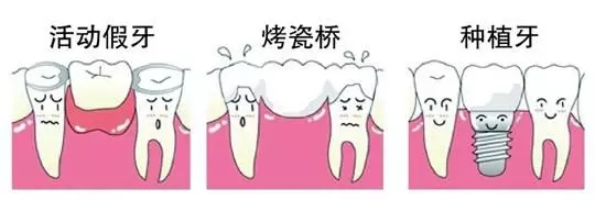 修複缺失牙有幾種方式PK
