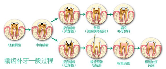 深圳三甲醫院補牙價(jia) 格