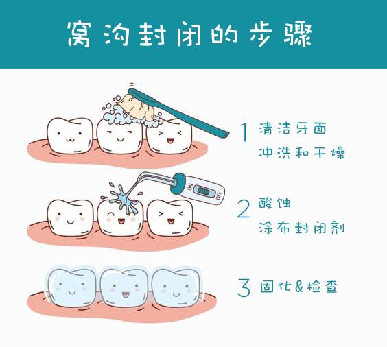做窩溝封閉多少錢
