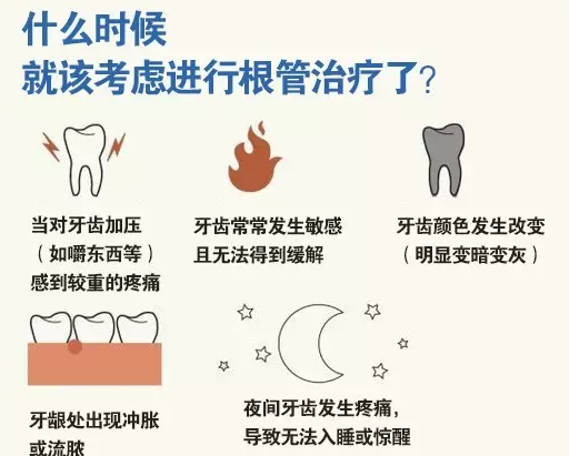 牙根管治療多少錢
