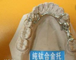 純鈦全口義(yi) 齒價(jia) 格