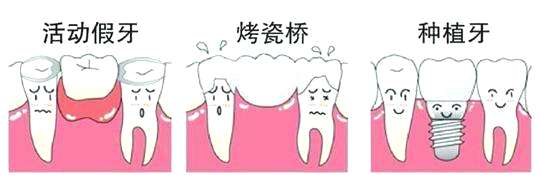 牙齒缺失修複哪種較便宜