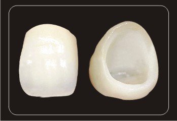 二氧化鋯全瓷牙多少錢一顆