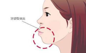 牙齒矯正要幾年時間