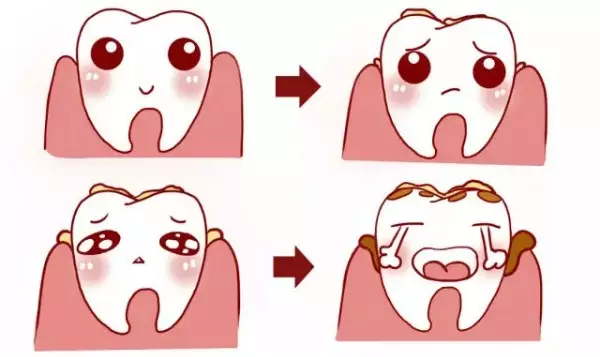 洗牙後牙縫變大正常嗎